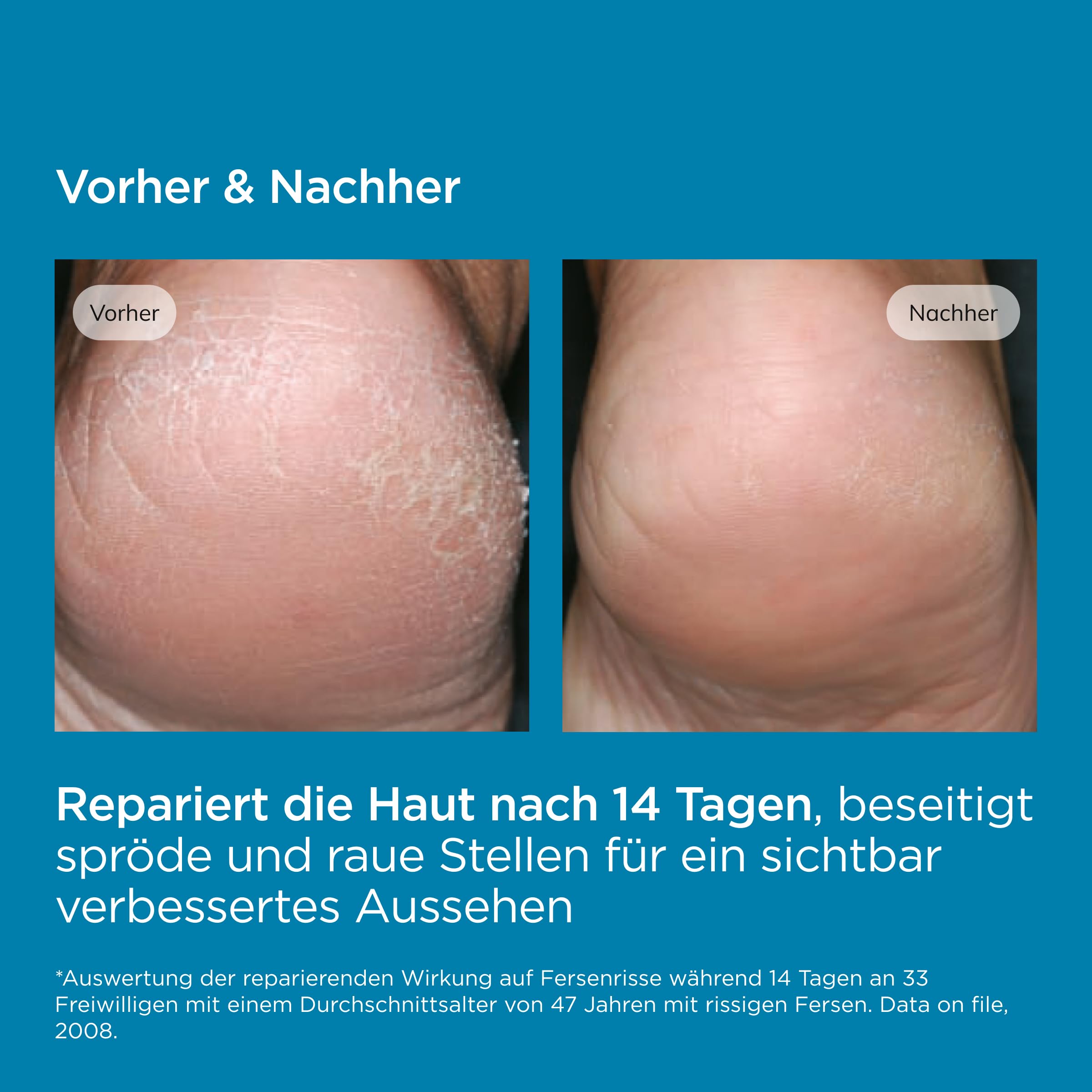 ISDIN Ureadin Podos Gel-Öl Fußpflege Schrunden