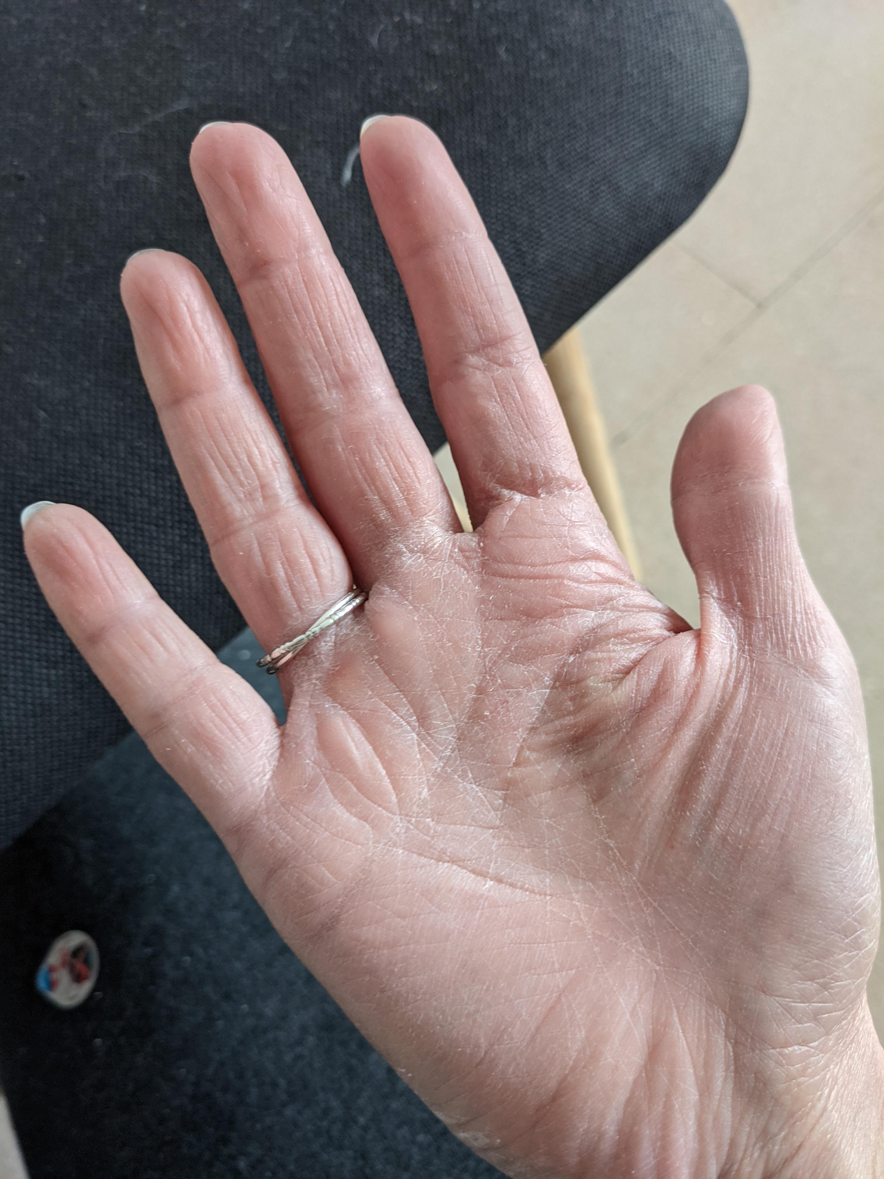 ISDIN Ureadin Repair Handcreme 50ml für sehr trockene Hände