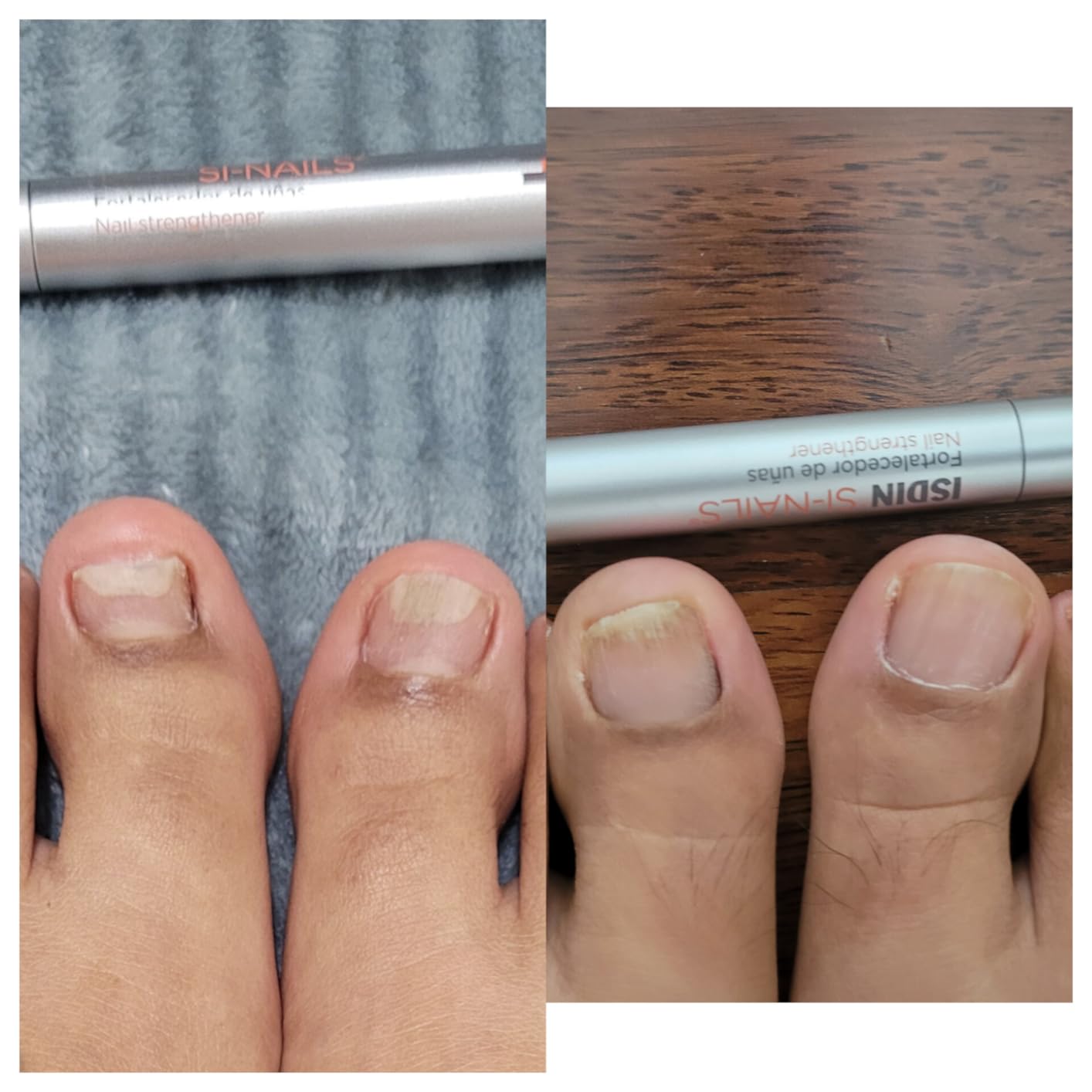 ISDIN Ureadin Podos Gel-Öl Fußpflege 75 ml