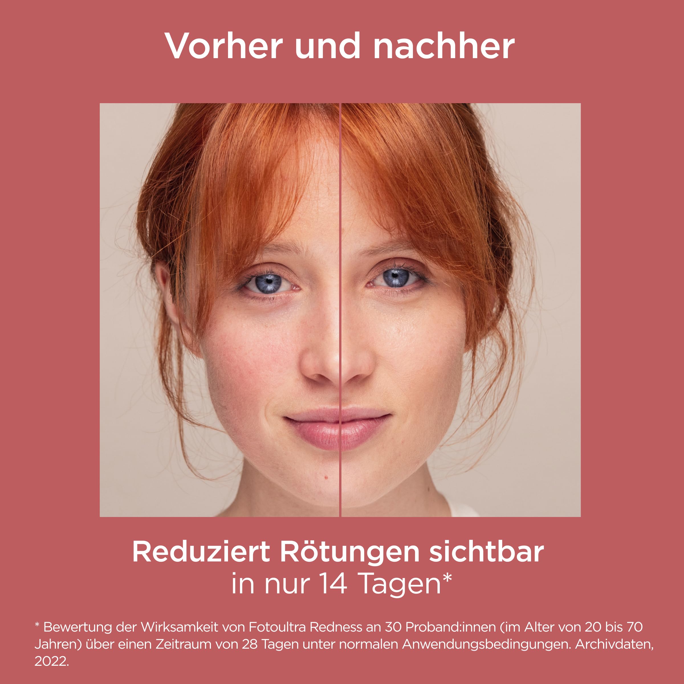 ISDIN Foto Ultra Redness Creme LSF50 50ml bei Rötungen