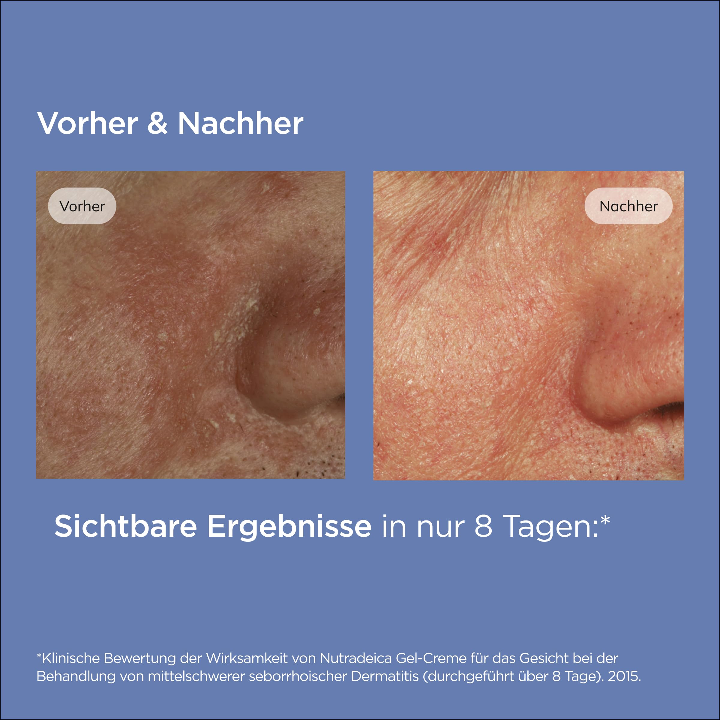 ISDIN Nutradeica Gel-Creme Gesicht 50 ml seborrhoisch