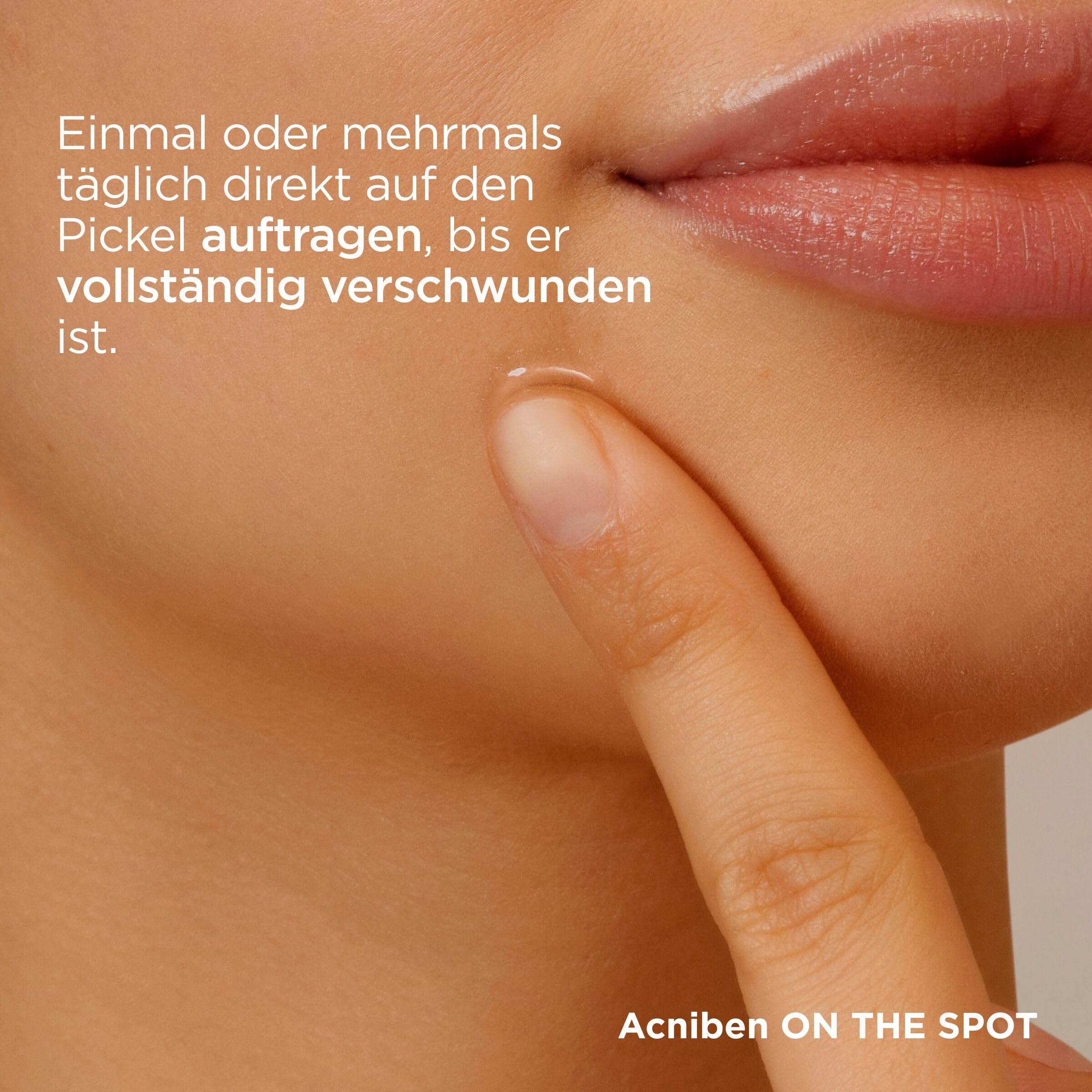 ISDIN Acniben On The Spot Pickel-Gel transparent Salicylsäure