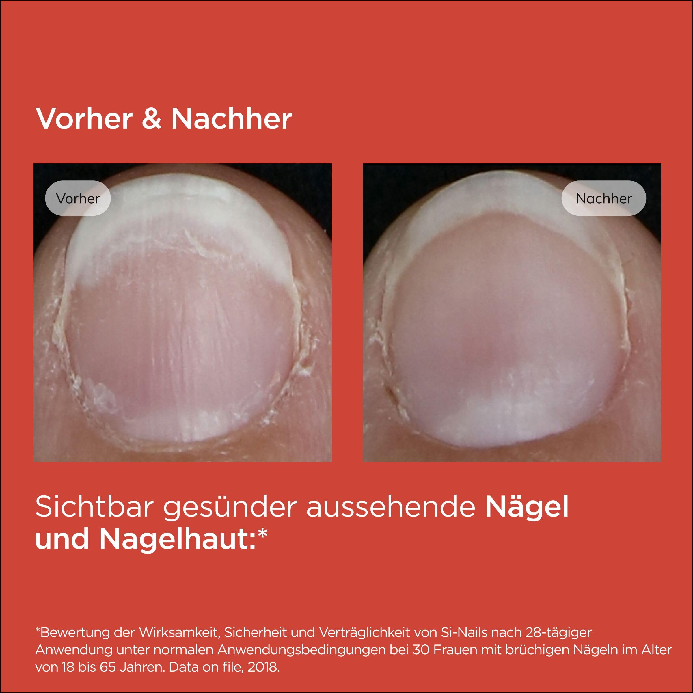 ISDIN Ureadin Podos Gel-Öl Fußpflege 75 ml