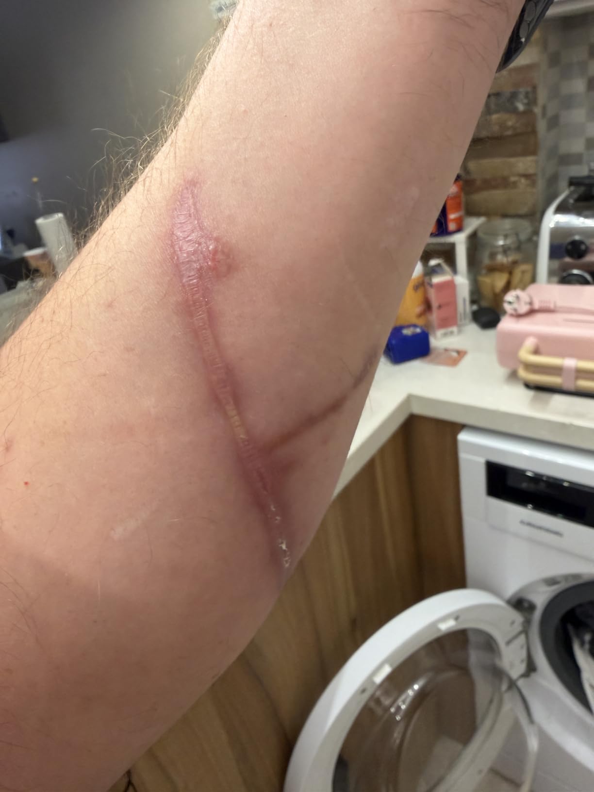 ISDIN Cicapost Narbencreme nach Narben und Reizung