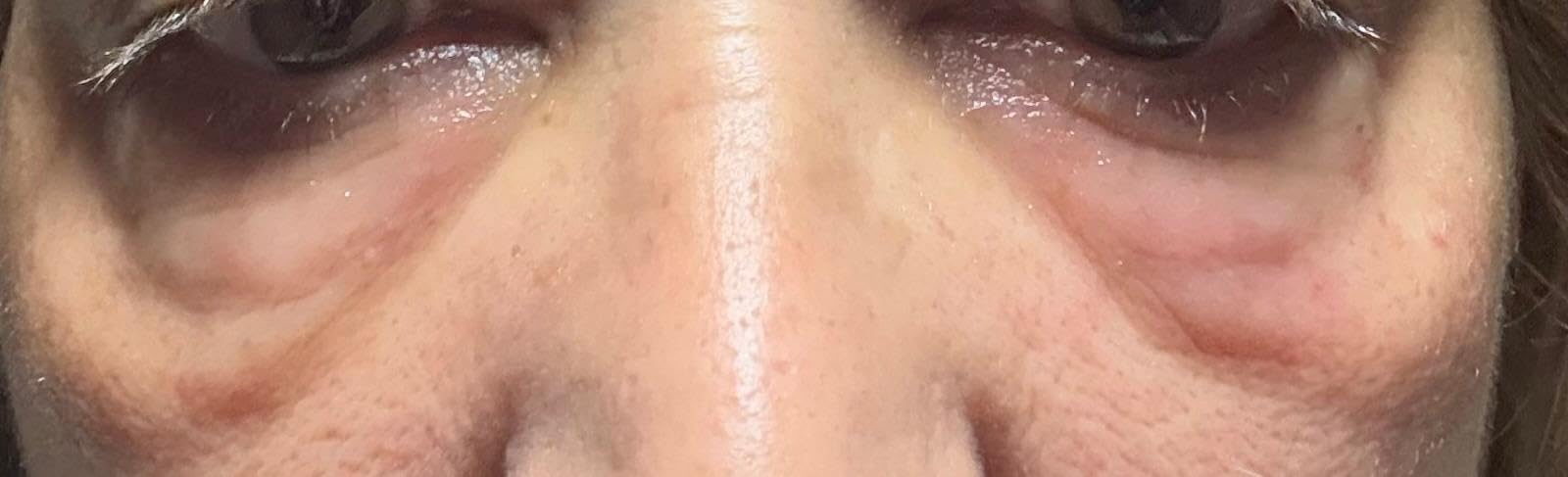ISDIN Isdinceutics Retinal Eyes Augenserum 20 ml gegen Falten