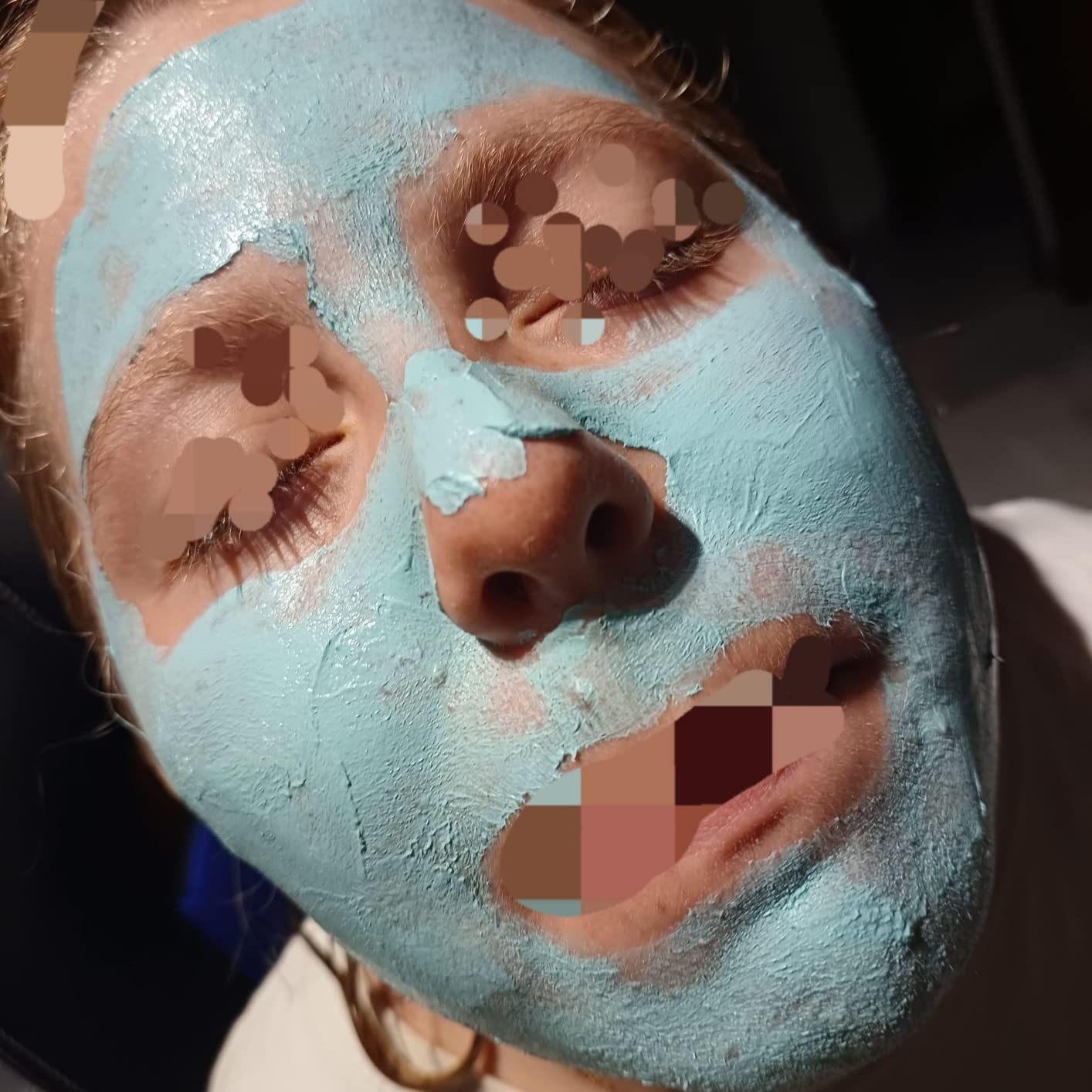 ISDIN Acniben Gesichtsmaske 75 ml gegen Pickel